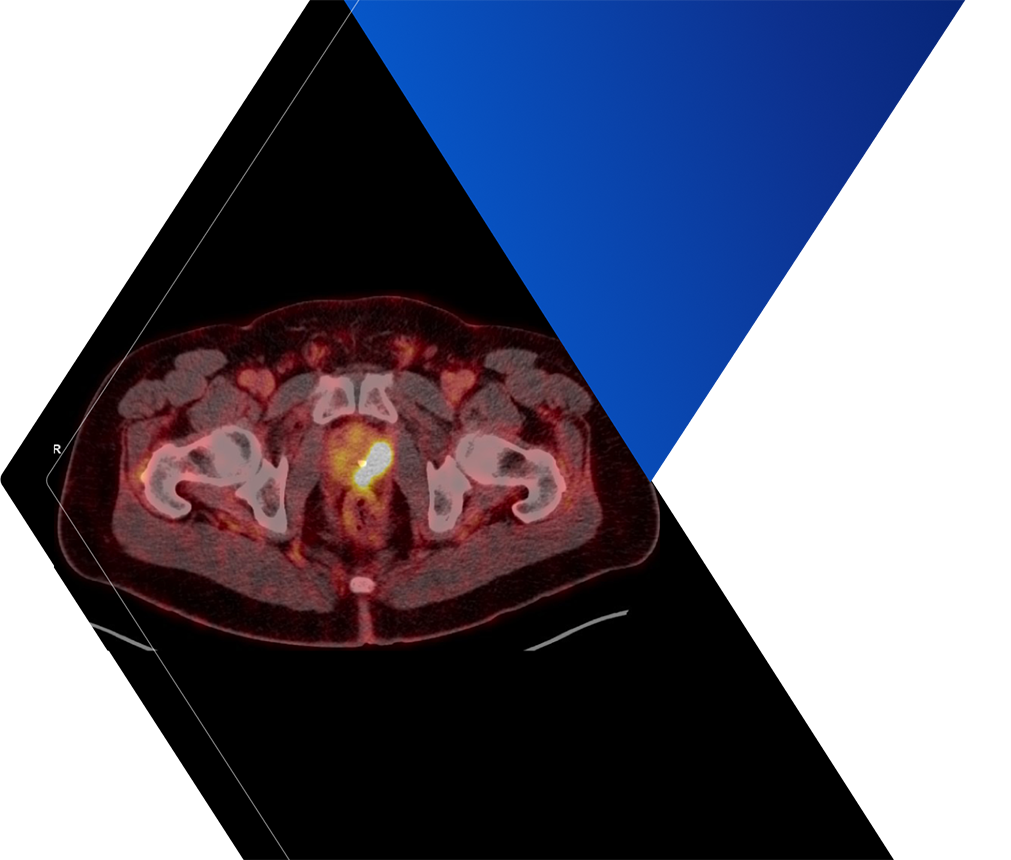 PET Scan Image