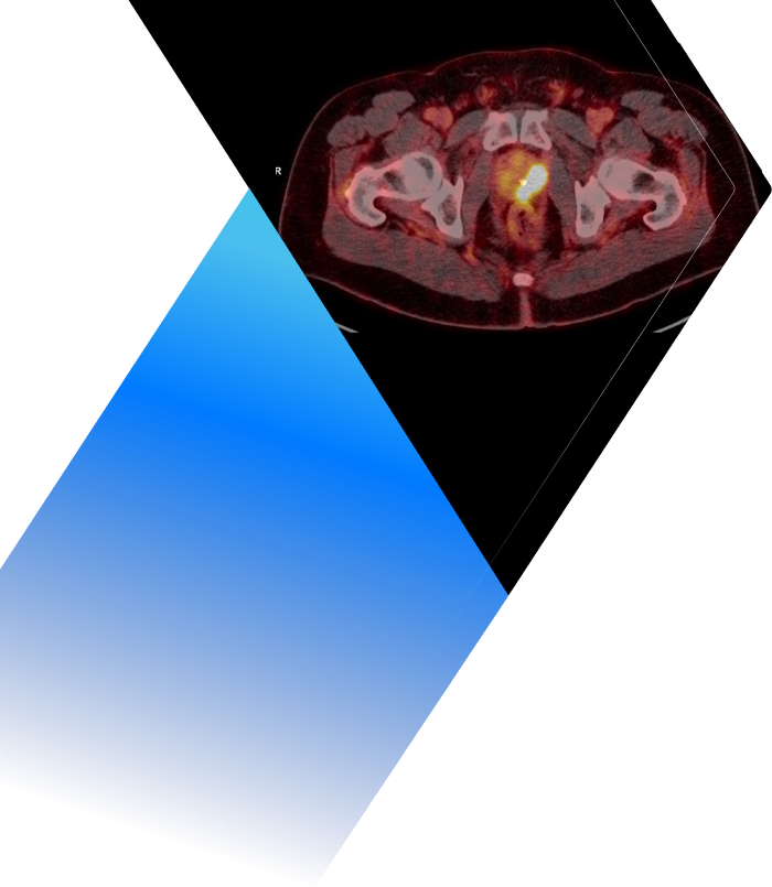 PET Scan Image